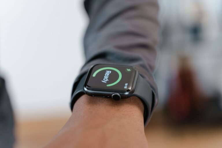 Smart band arm